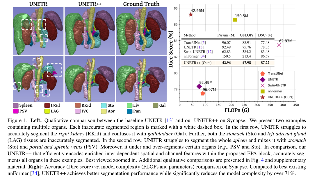 （新SOTA）UNETR++：轻量级的、高效、准确的共享权重的3D医学图像分割